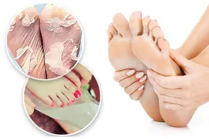 Get Newborn Baby Feet -  Exfoliating Foot Masks x 2 Packs