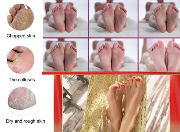 Get Newborn Baby Feet -  Exfoliating Foot Masks x 2 Packs